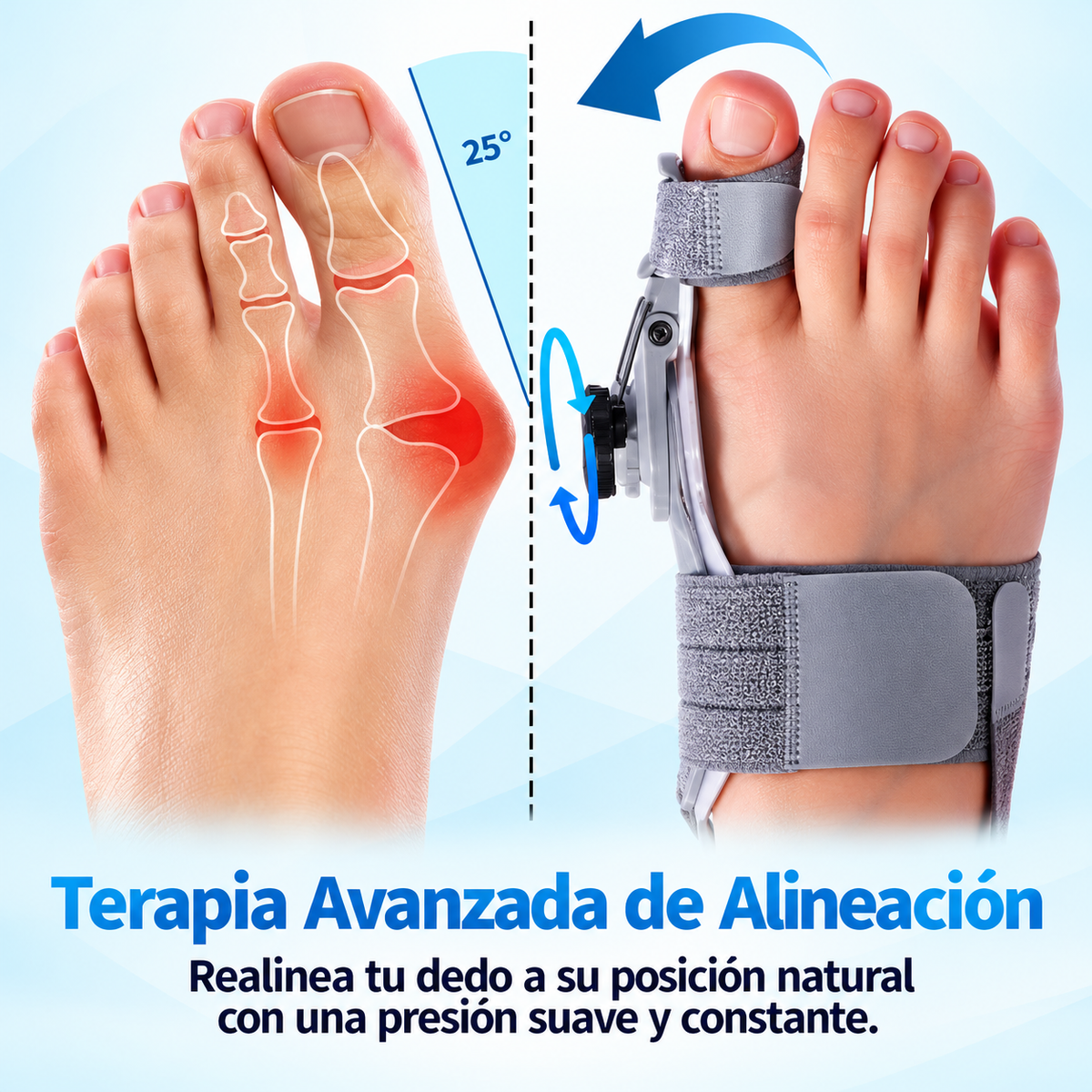 PODIOFIX · Férula ajustable para juanetes